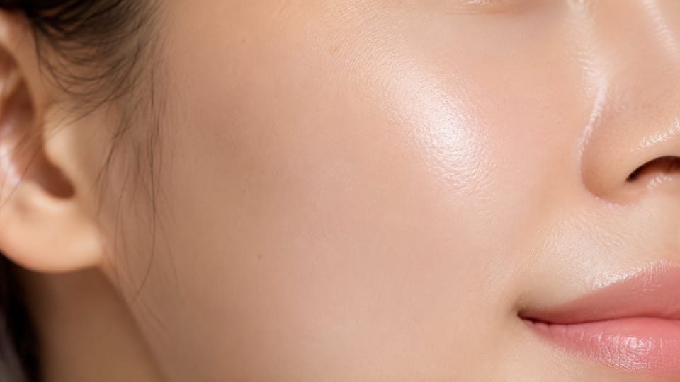 Bề mặt da cải thiện rõ sau lộ trình điều trị sẹo rỗ