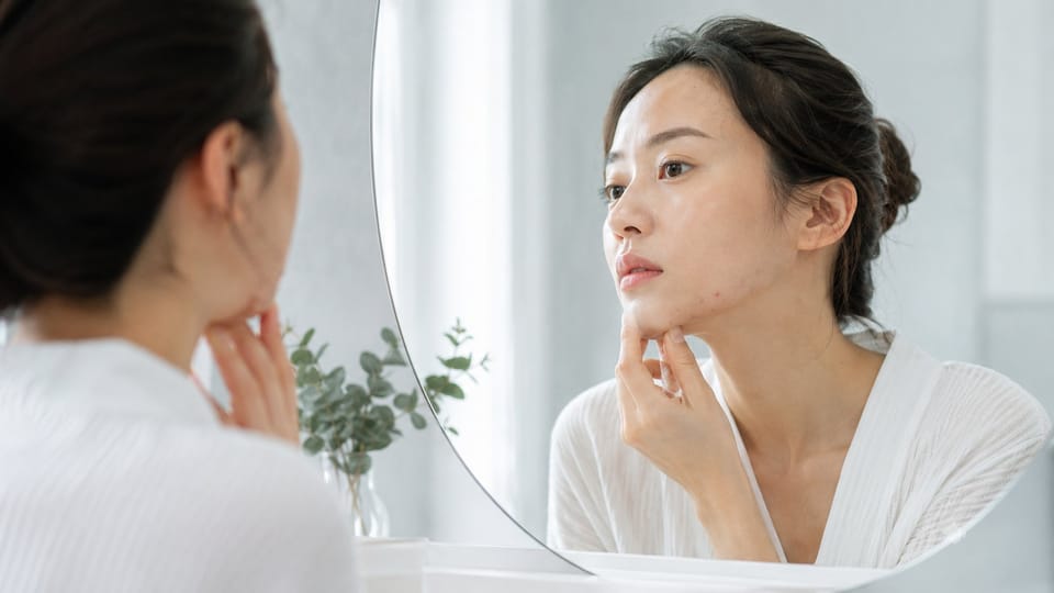 Mụn người lớn: tại sao vẫn nổi mụn sau 25 tuổi và cách kiểm soát