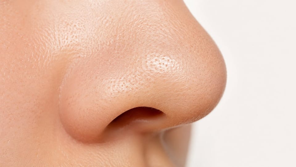 Sebaceous Filaments Là Gì? Phân Biệt Với Mụn Đầu Đen và Cách Xử Lý Đúng