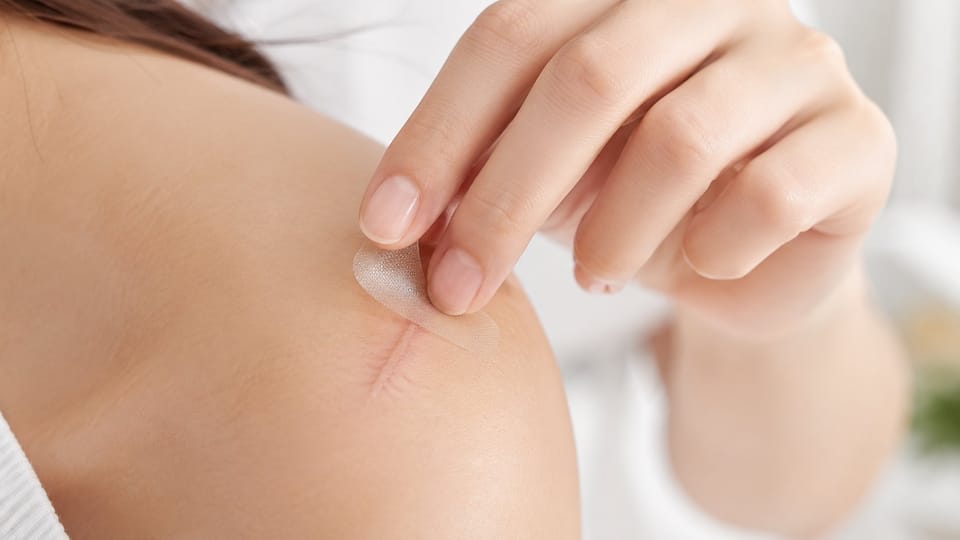 Silicone Gel Và Tấm Silicone Trị Sẹo: Hiệu Quả Với Loại Sẹo Nào?